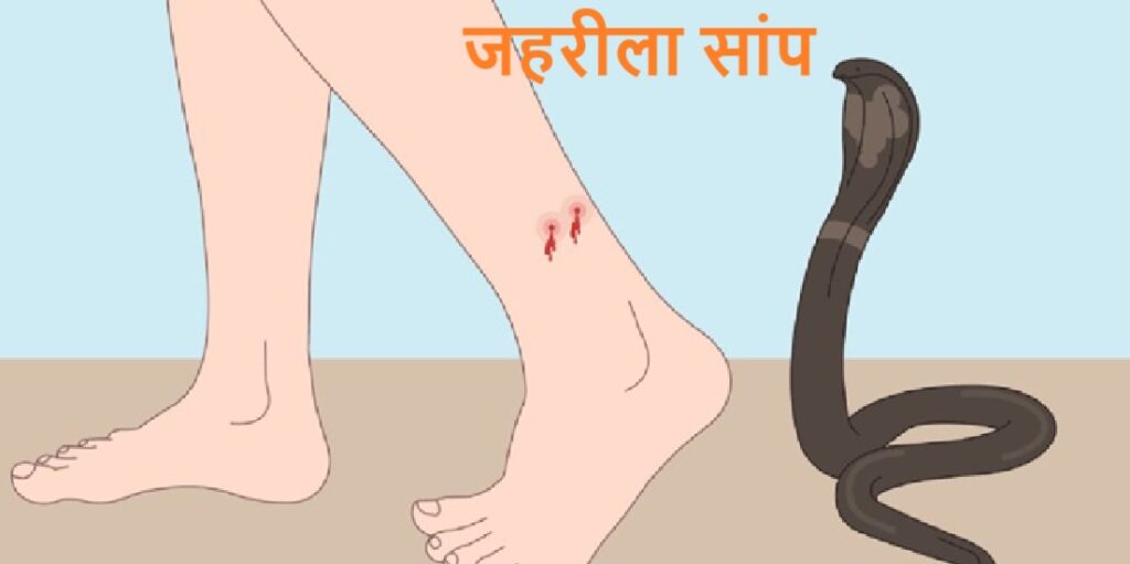 पति ने जान पर खेलकर मुंह से जहर चूसकर पत्नी की बचाई जान