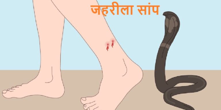 पति ने जान पर खेलकर मुंह से जहर चूसकर पत्नी की बचाई जान