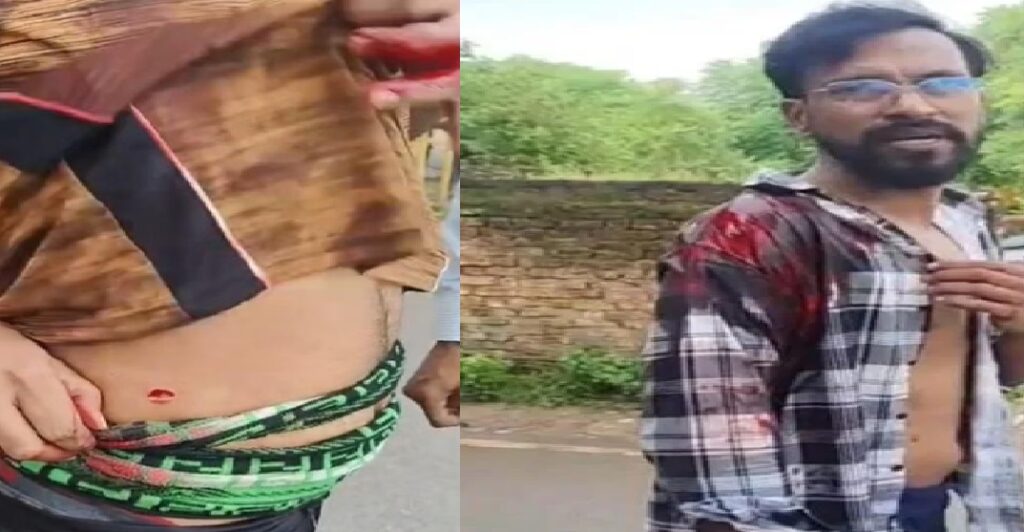 ठाकुरगंज में दोस्तों के बीच विवाद खूनी झगड़े में बदला, धारदार हथियार से हमला
