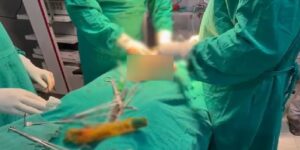 नशे में युवक ने कर दी खतरनाक हरकत, निजी अंग में डाली बोतल, करनी पड़ी सर्जरी तब बची जान