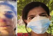 गोवर्धन परिक्रमा में श्रद्धालु युवती पर हमला, नाक काटकर आभूषण ले गया युवक